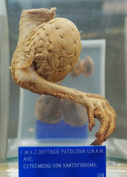 Archivo:Extremidad con Xantofibroma.jpg